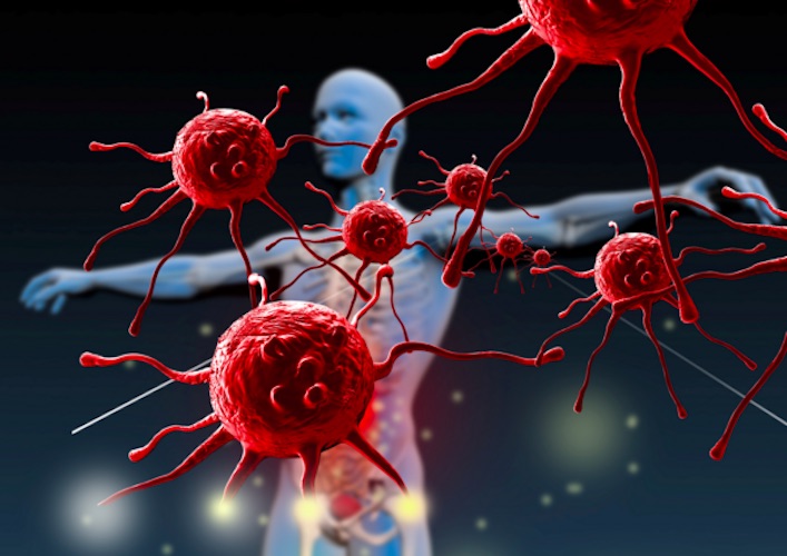 Rapporto Osservasalute 2017: al Sud si muore di più per cancro e malattie, ecco i dettagli per l’Alto Tavoliere