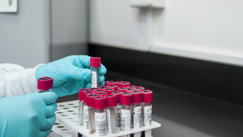 Coronavirus, in arrivo 2800 test rapidi in Puglia, si parte dall’ IRCSS Istituto Tumori Giovanni Paolo II di Bari